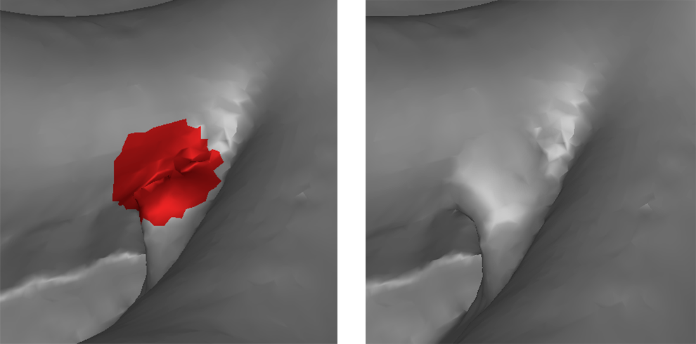 Using Defeature brush.